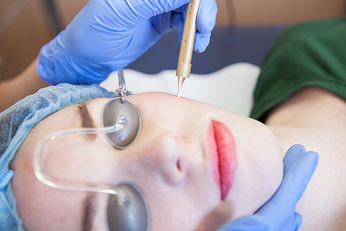rosacea behandelen tilburg
